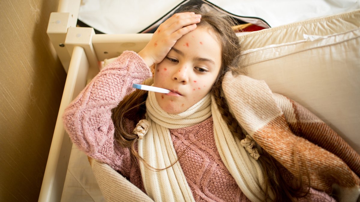 Yemen'de kızamık alarmı! 7 ayda 413 kişi hayatını kaybetti