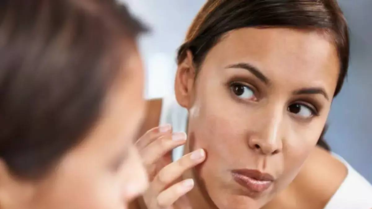 Yüzdeki tüylerden kurtulmak meğer bir fincan Türk kahvesi kadar yakınmış! Son dönemin popüler yöntemi