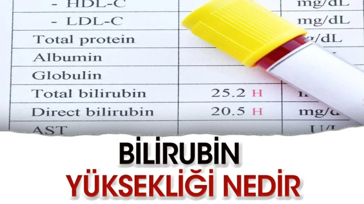 Total Bilirubin Yüksekliği Belirtileri: Sağlığınızı Anlamak