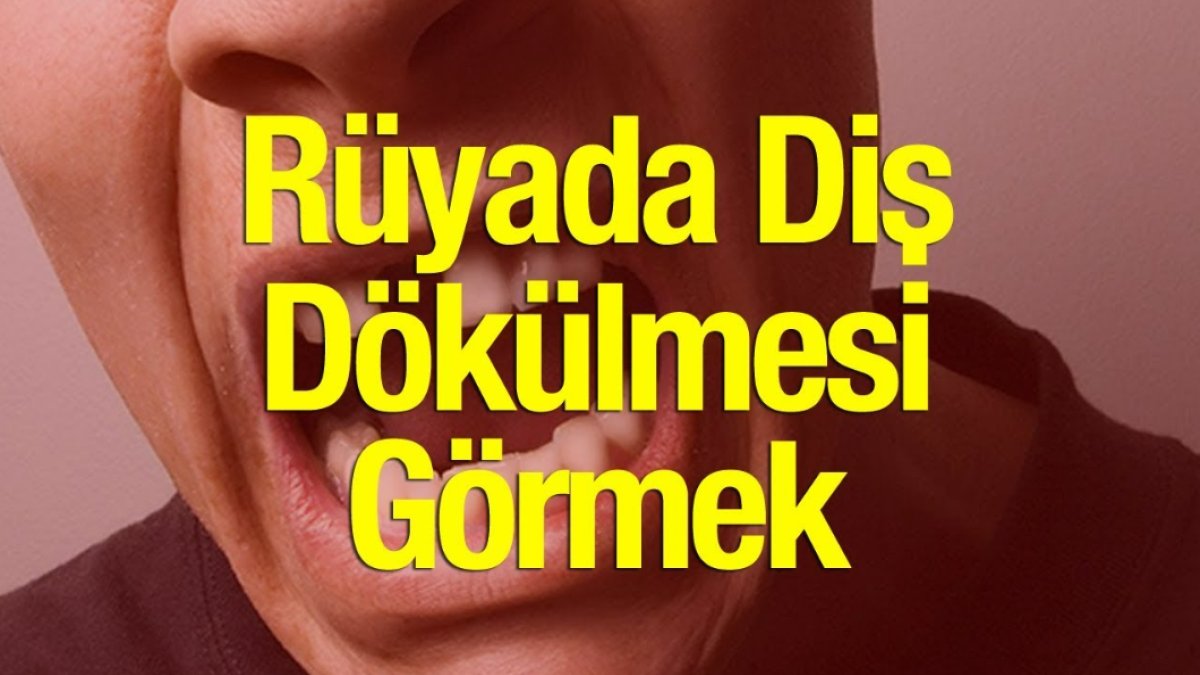 Rüyada Dişlerinin Döküldüğünü Görmek: Anlamı ve Yorumları