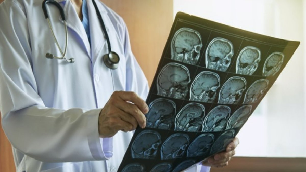 Beyin ve Sinir Cerrahisi: Sinir Sistemine Odaklanan Önemli Bir Tıbbi Uzmanlık Alanı