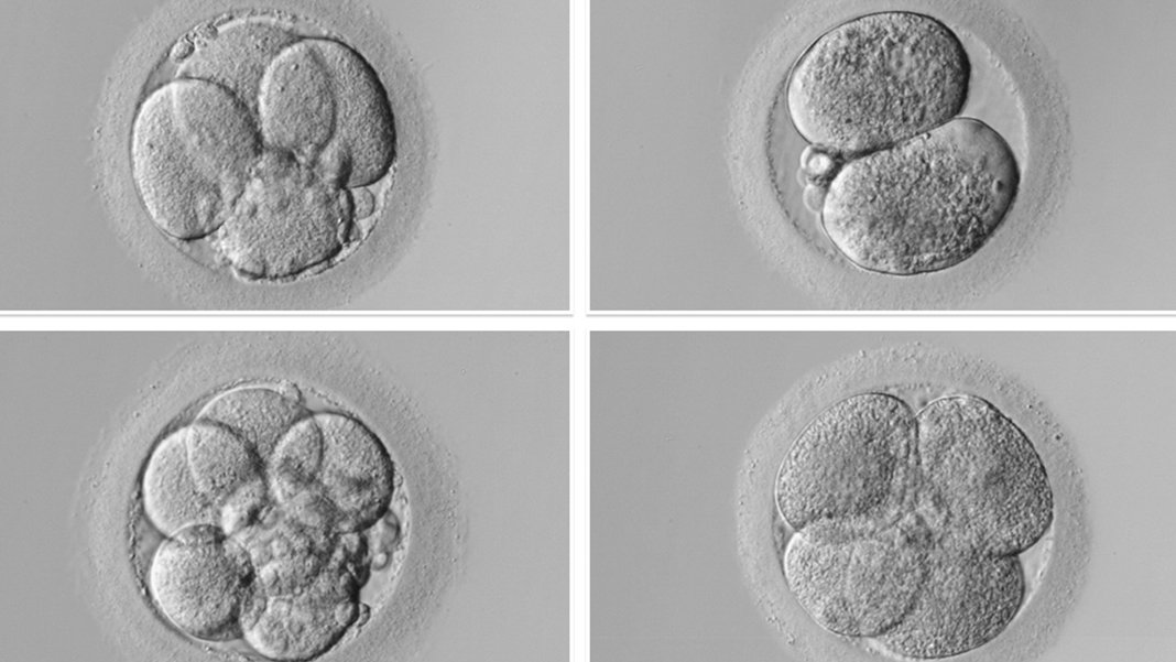 Bilim dünyasında çığır açan gelişme: Laboratuvarda insan embriyosu gelişti