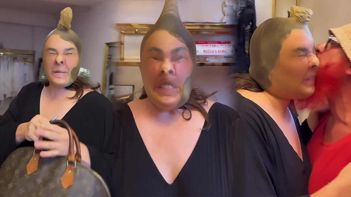 Ünlü oyuncu, estetik kurbanı oldu! Görenler tanıyamadı, gerçek daha sonra ortaya çıktı