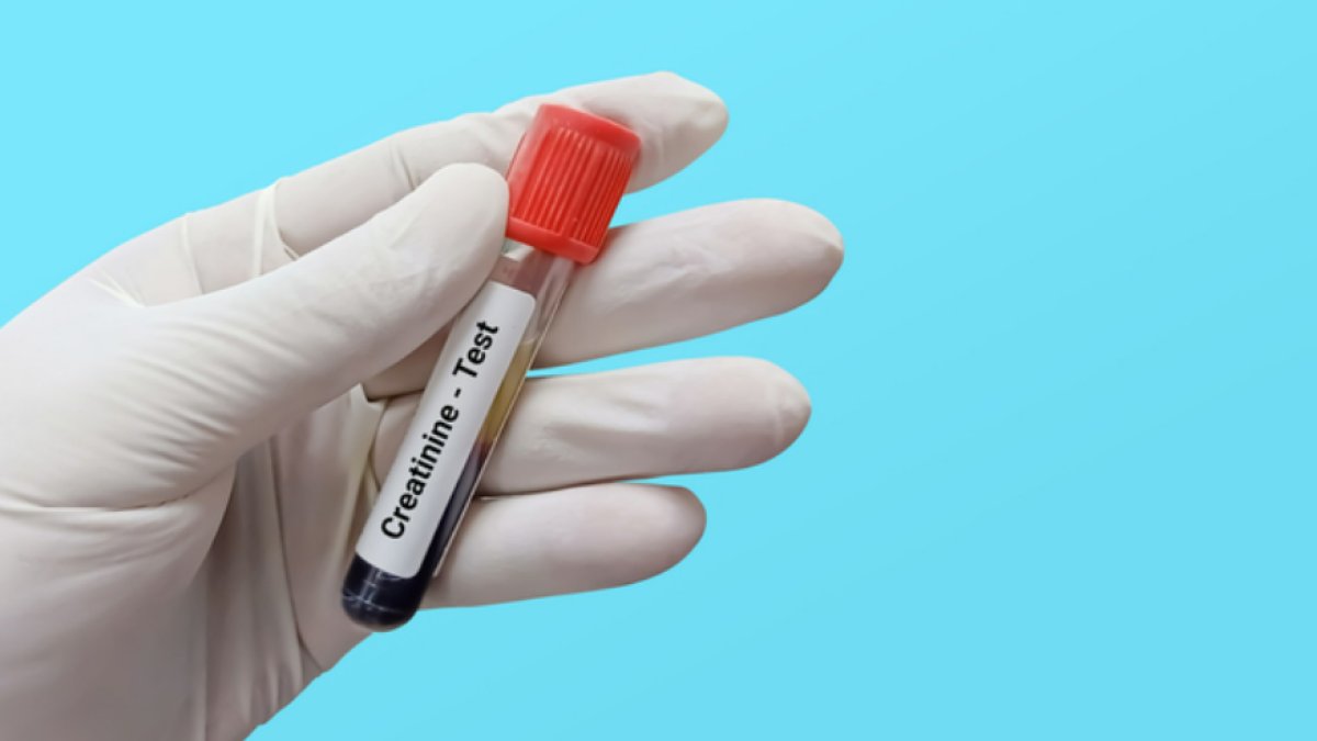 Kreatinin Düşüklüğü Neden Olur?