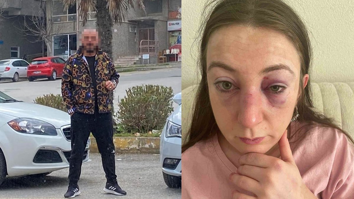 Erkek şiddetinin yeni mağduru Sibel oldu: Ölmekten korkuyorum