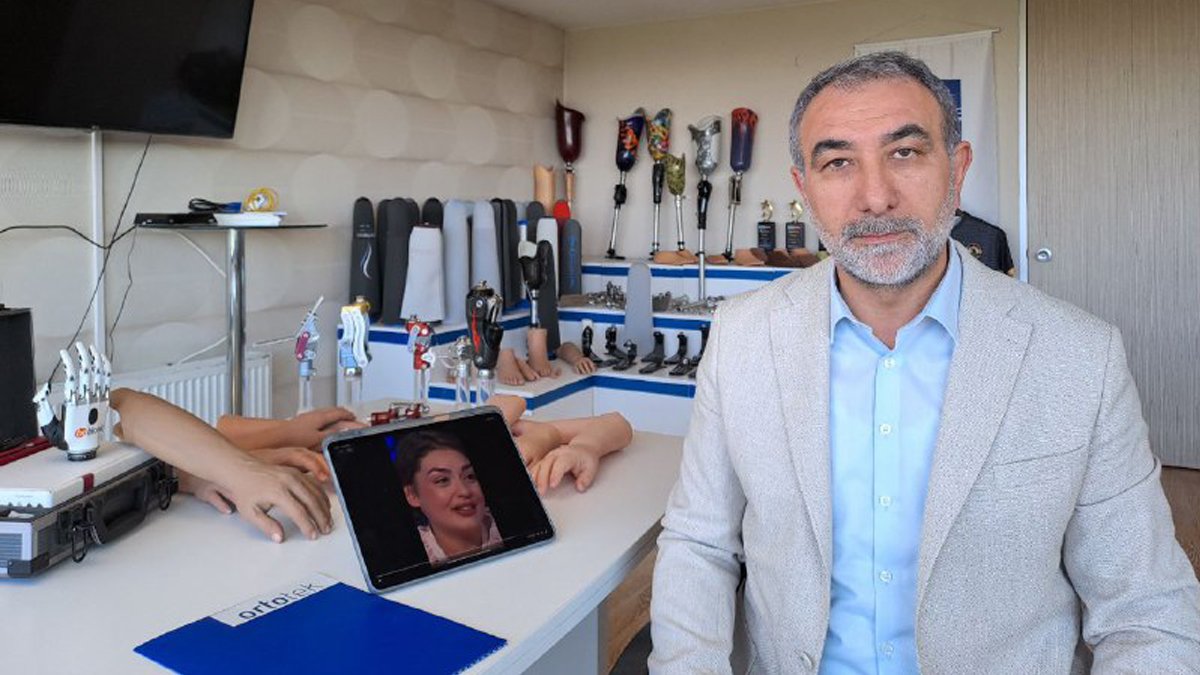 Yarışmadan 1 milyon TL kazanmıştı: Rabia'nın kol protezini ücretsiz karşılayacak