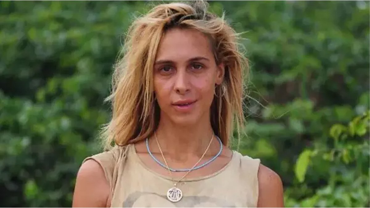Survivor'dan çıkan estetik yaptırıyor! Duygu Bal değişimin dibine vurdu "annesi görse tanıyamaz"