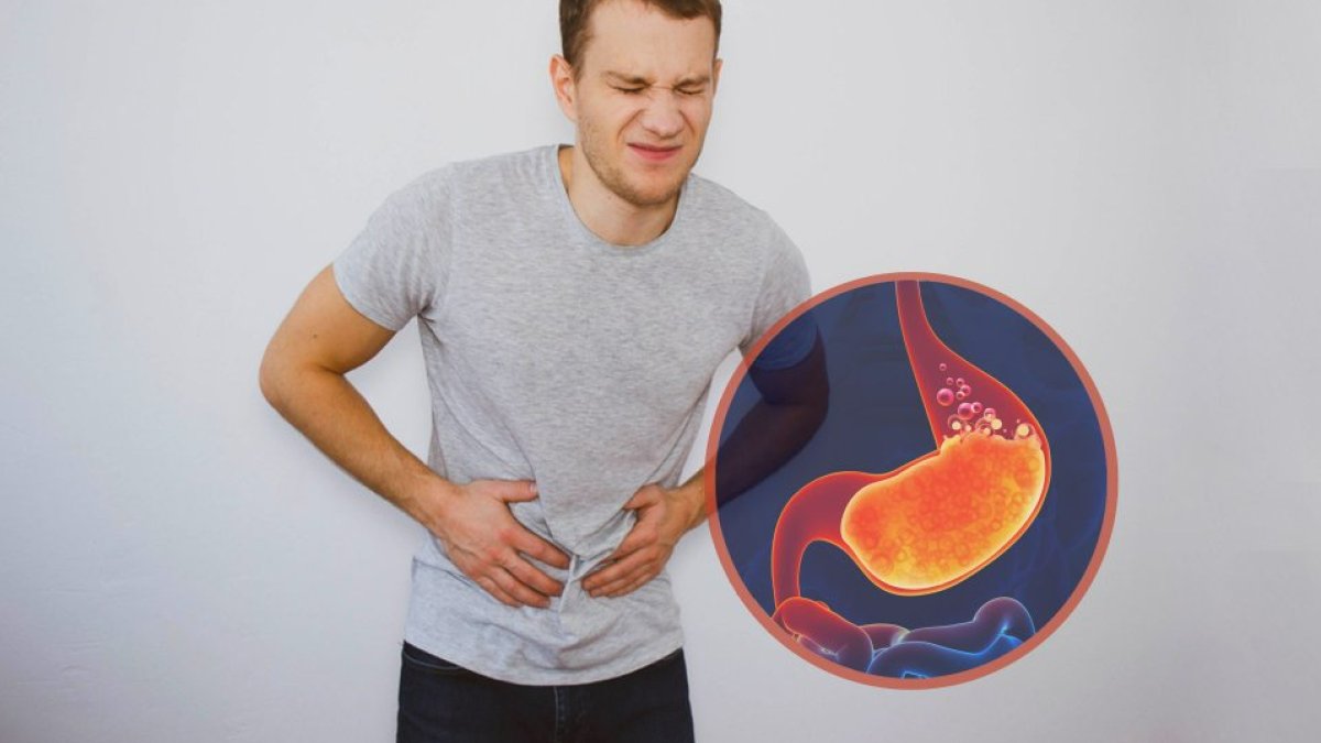 Mide Ekşimesine Ne İyi Gelir: Rahatlatıcı Çözümler ve Pratik Öneriler