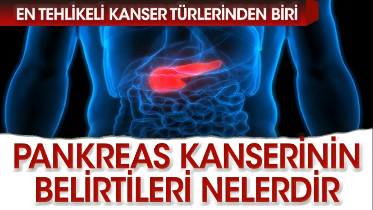 Pankreas Kanseri Belirtileri: Erken Teşhis Hayat Kurtarır