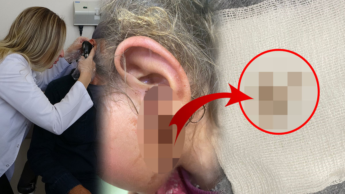 Kulak kaşıntısıyla hastaneye götürdüler: Doktor, meslek hayatının şokunu yaşadı! Canlı canlı tam 23 adet...