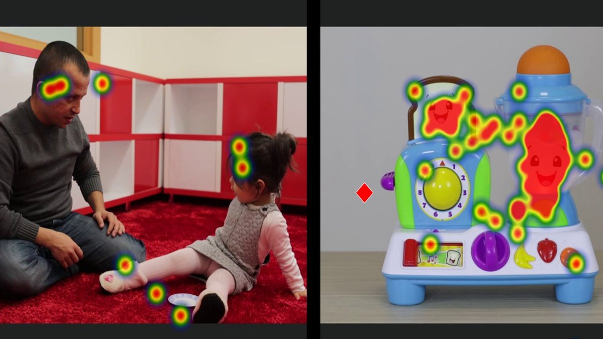 Otizmde erken teşhis için yapay zeka kullanılacak