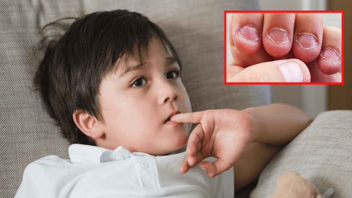 Özellikle çocuklar bunu çok yapıyor! Uzmanların önerdiği bu yöntem tırnak yemeyi şıp diye unutturuyor