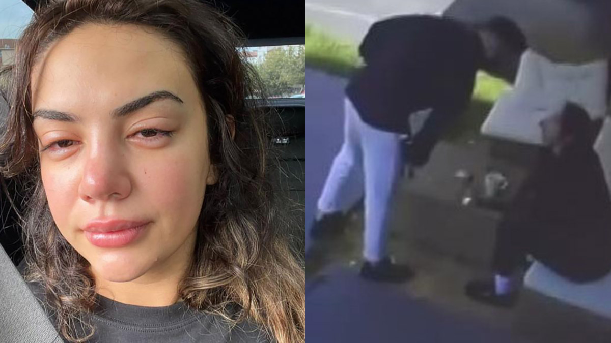 Eski eşinden şiddet gördüğünü söyleyen şarkıcı Ece Ronay yardım istedi