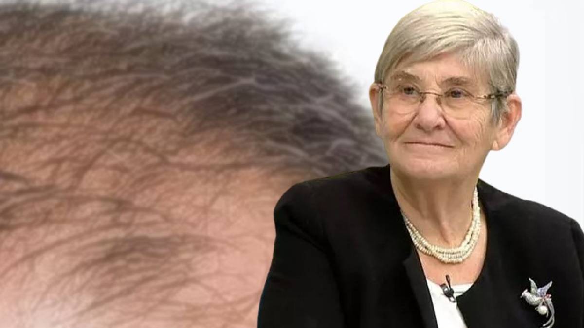 Bunları yemeden bir kez daha düşünün! Canan Karatay uyardı: O besinler erkeklerde kellik yapıyor