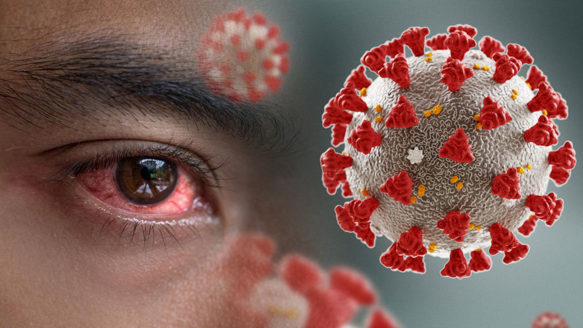 Korona yanında melek kalır! Kırmızı göz salgınında büyük artış: Uzmanlar harekete geçti