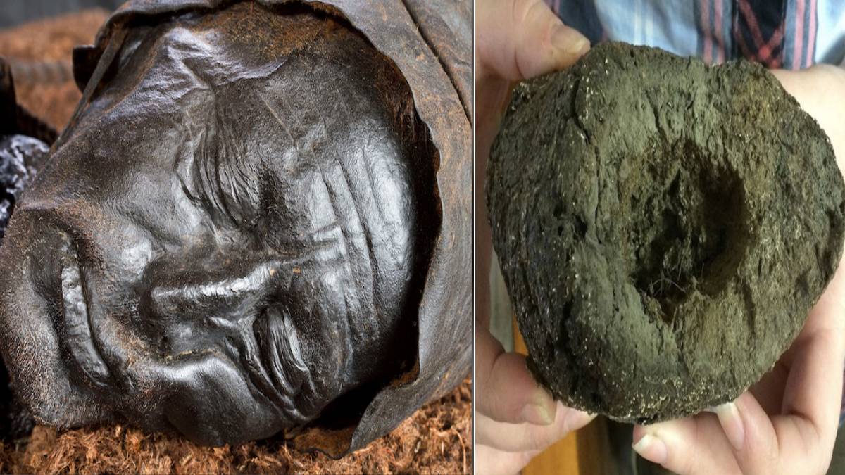 Kabızlıktan ölmüştü! Midesinden öyle bir şey çıktı ki... Aylar boyunca hep o iğrenç canlıyı yemiş