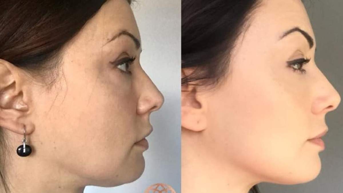 Bunu yapan 50 yaşında bile 20'lik gibi kalıyor! Farkı gözlerinizle göreceksiniz: Üstelik çok da basit