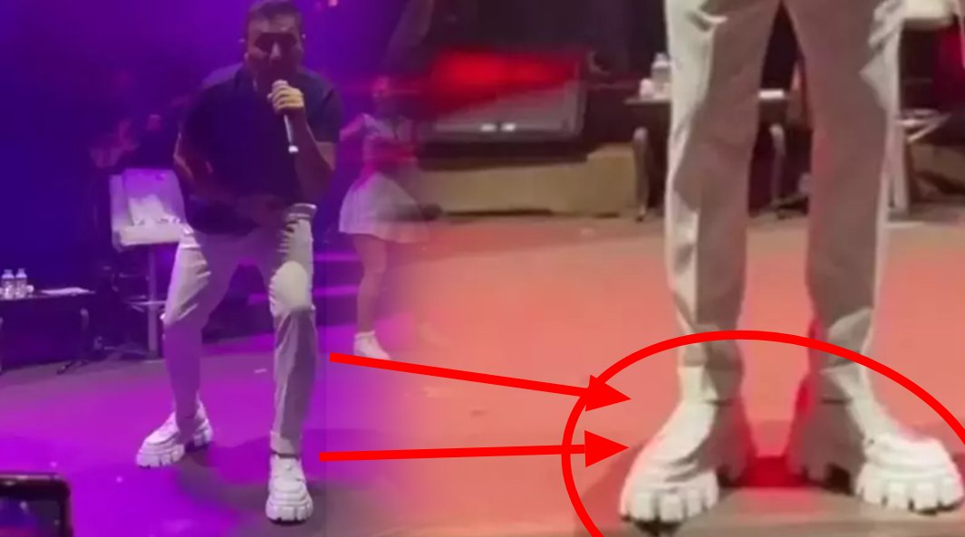 Ayakkabıları dalga konusu olmuştu! Siz bir de fiyatına bakın: 10 cm uzamanın bedeli dudak uçuklattı