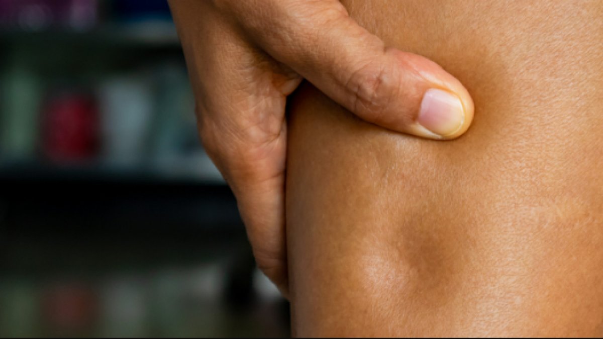 Vücuttan Ödem Nasıl Atılır: Sağlıklı Bir Yolculuk İçin İpuçları