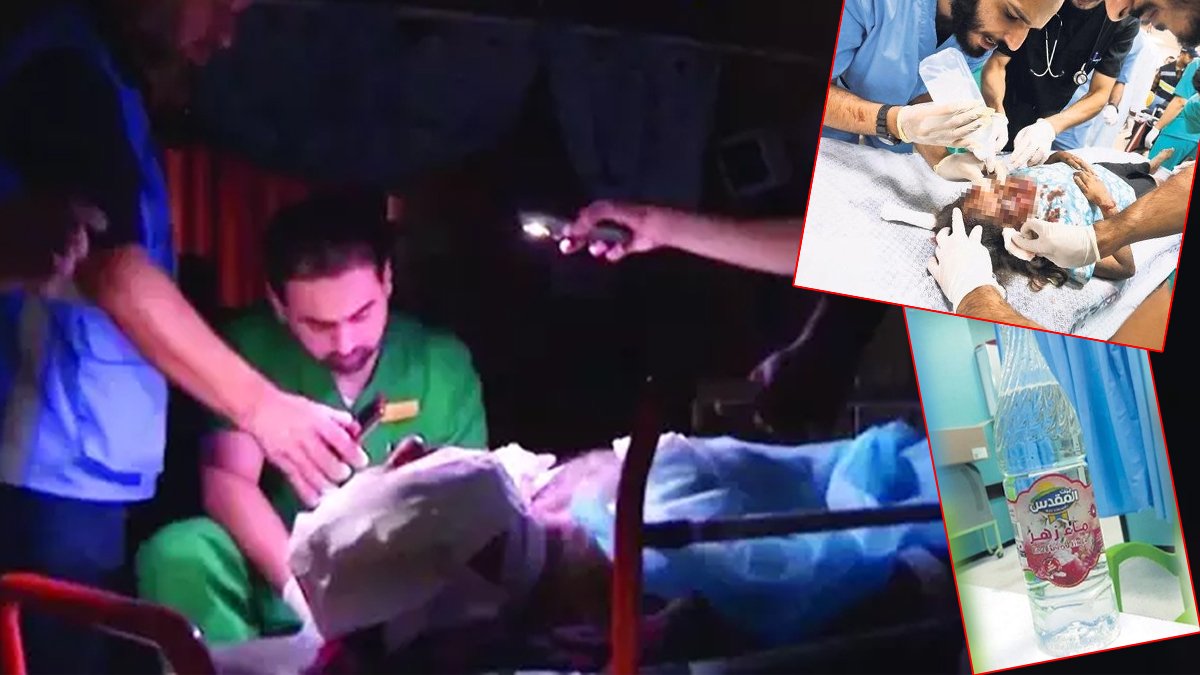 Gazze'de sağlık sistemi çöküşün eşiğinde! Narkozsuz, telefon ışığında ameliyat