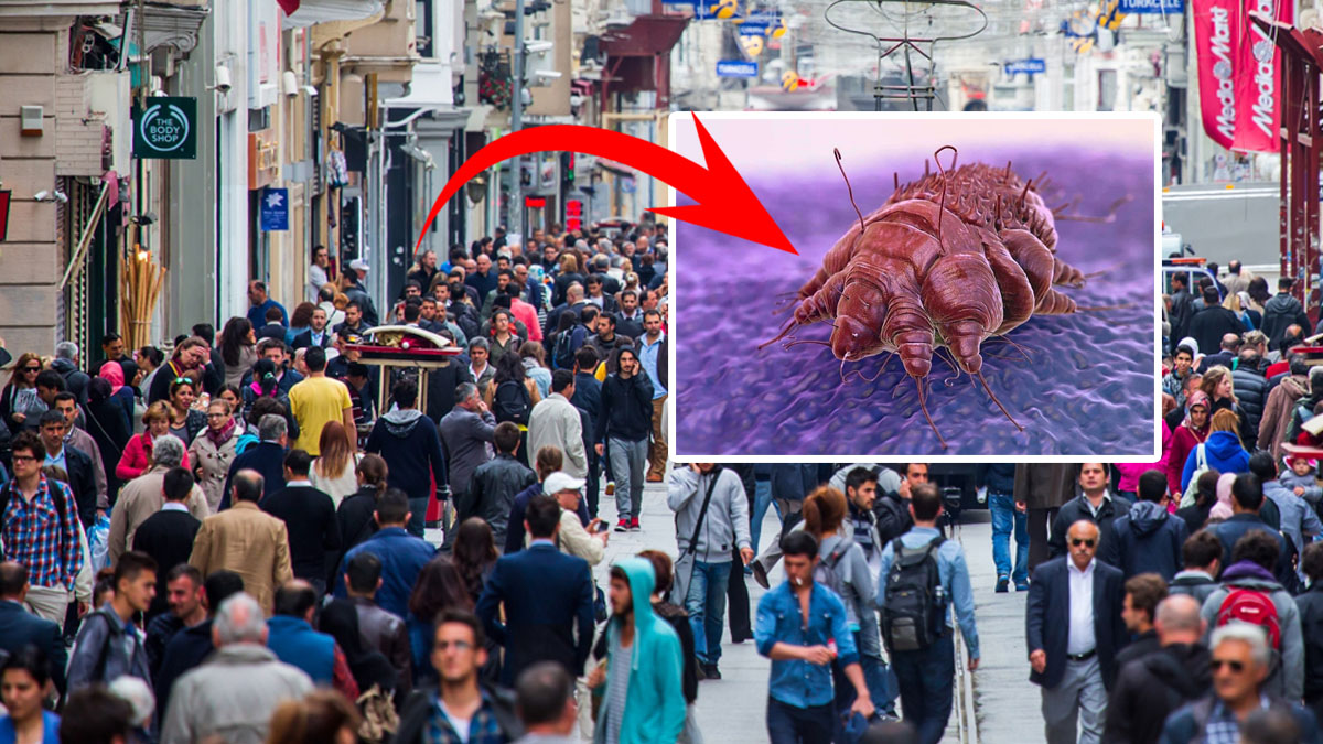 Türkiye'de büyük panik! 20 soruda uyuz hastalığı: Nasıl bulaşır? Ne yapmalı?
