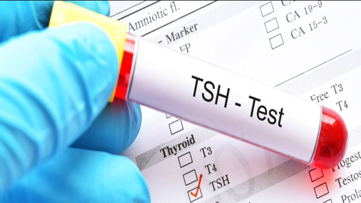TSH Nedir: Tiroid Uyarıcı Hormonunun Anatomisi
