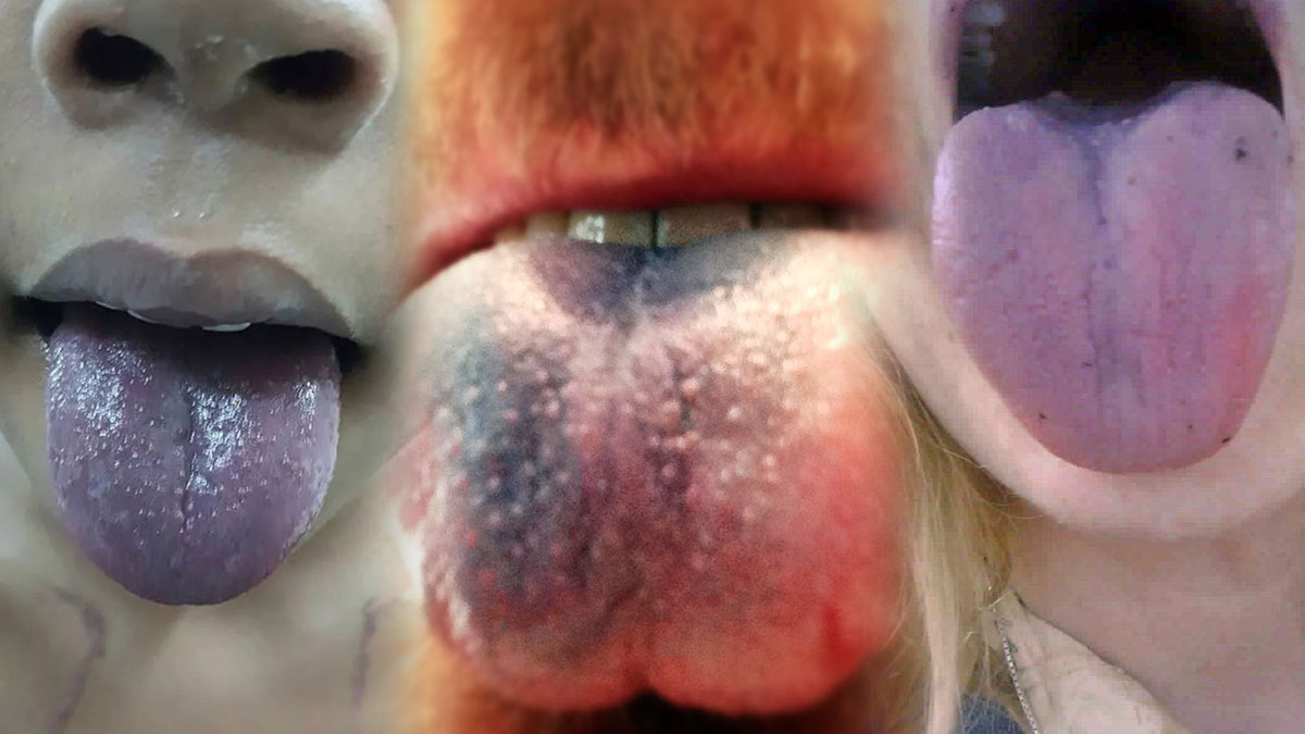 Şimdi de 'mavi dil' salgını başladı! Bakan, 'Etkili bir aşıya ihtiyaç var' diyerek durumun vahametini anlattı