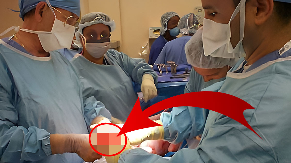 Doktor, meslek hayatının şokunu yaşadığını itiraf etti! Ne yapsa kilo veremedi, doktora gitti, apar topar ameliyata aldılar