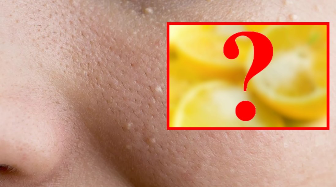 Yüzdeki yağ bezelerine kesin çözüm! Tüm pürüzleri alıyor, bu iki malzeme pahalı kozmetiklere bile taş çıkaracak