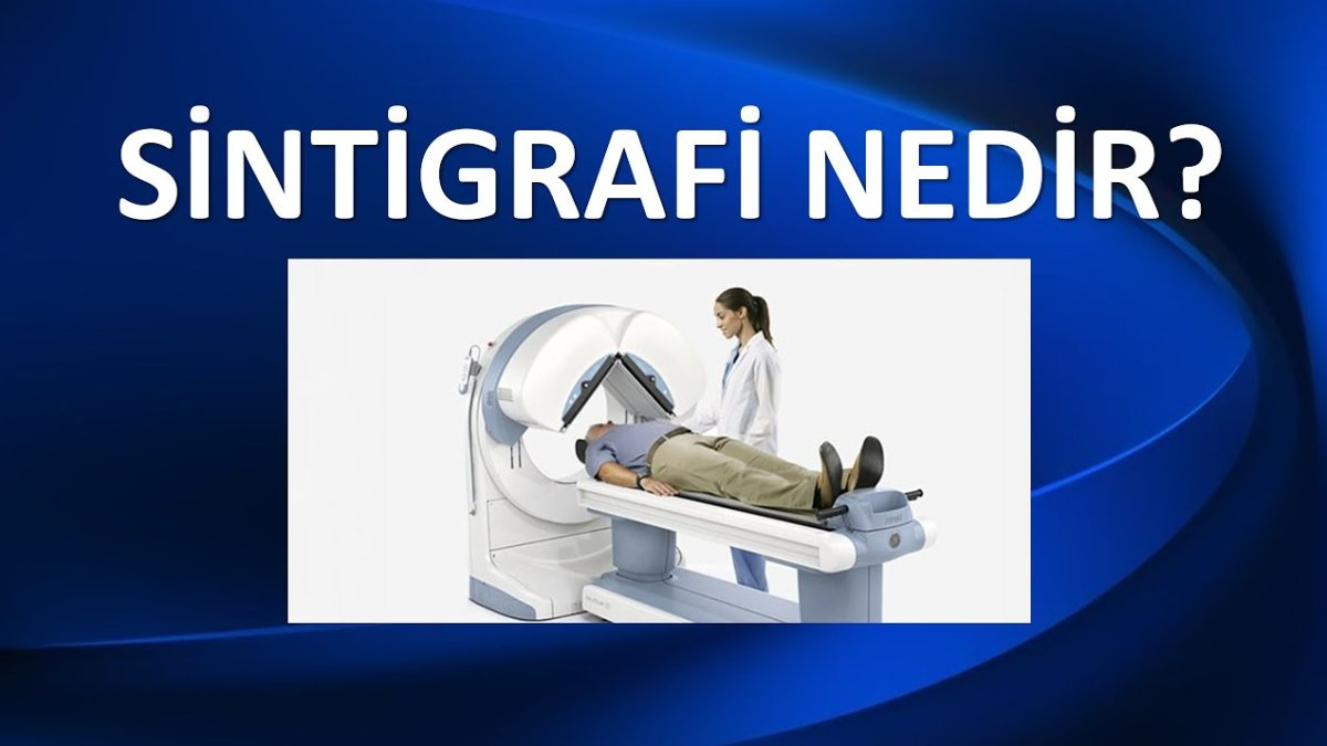 Sintigrafi Nedir: Tıbbi Görüntüleme Teknolojisinin Harikaları