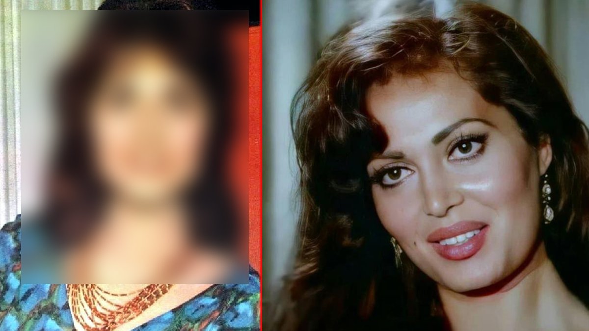 Meğer Türkan Şoray'da estetik harikasıymış... Türk sinemasının efsane güzeli kendini baştan yaratmış!