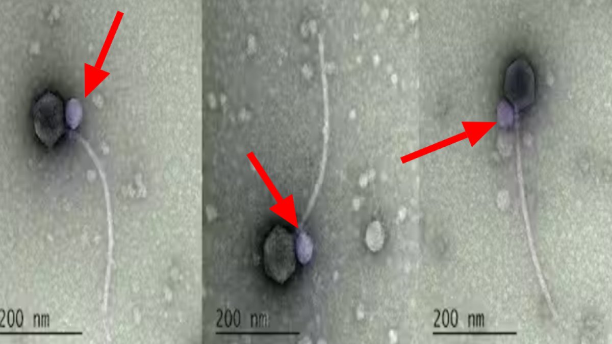 Bilim dünyasında inanılmaz keşif: Vampir virüsleri ortaya çıktı! Başka virüslere de saldırıyor