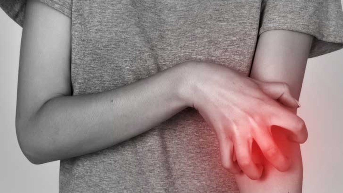 Uyuz hastalığındaki hurafelere uzmanlardan yanıt: Hayvandan insana bulaşır mı?