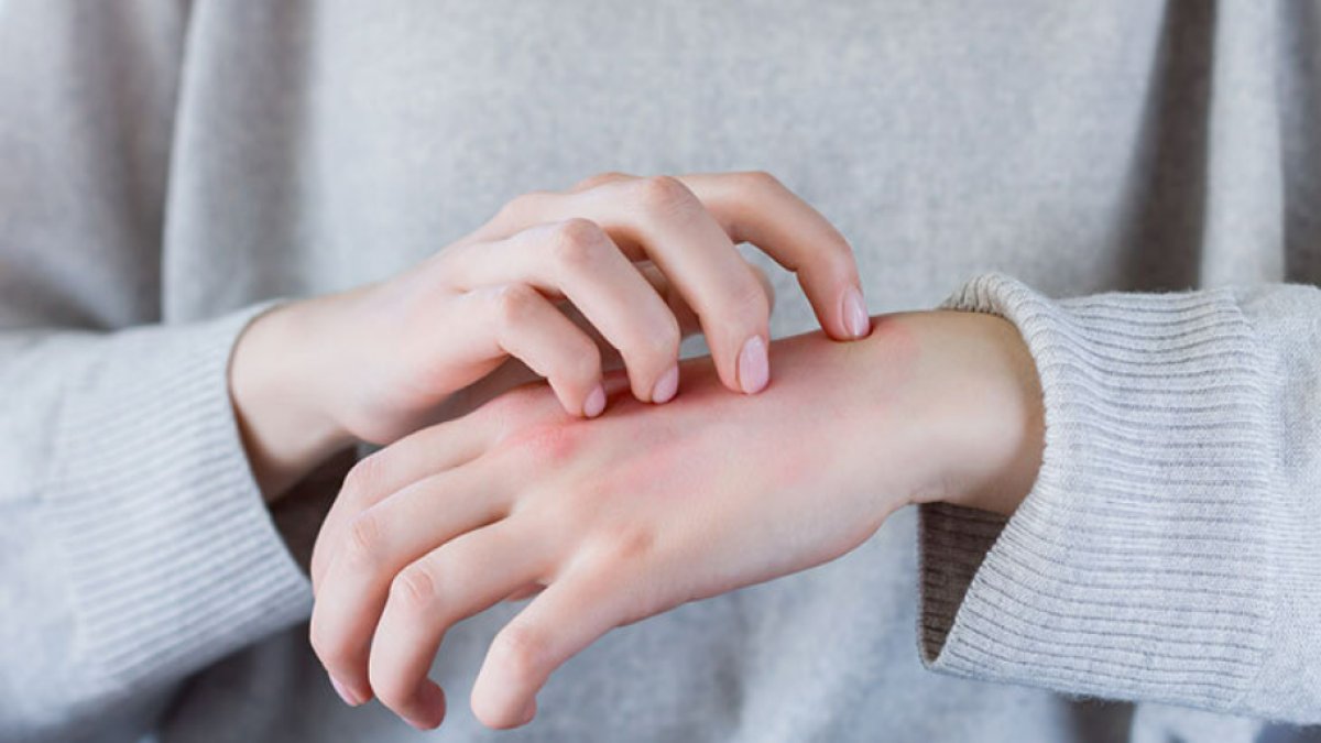 Sinirsel Kaşıntı Belirtileri: Ruhsal ve Fiziksel Etkiler