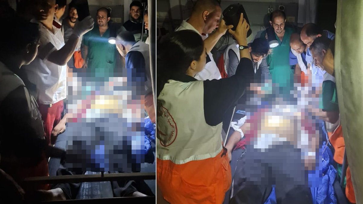 İsrail'in karanlık zulmü... Gazze'de el feneri ışığıyla ameliyat