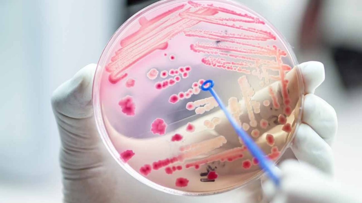 Sepsis Nedir? İşte Ayrıntılı Bir Bakış