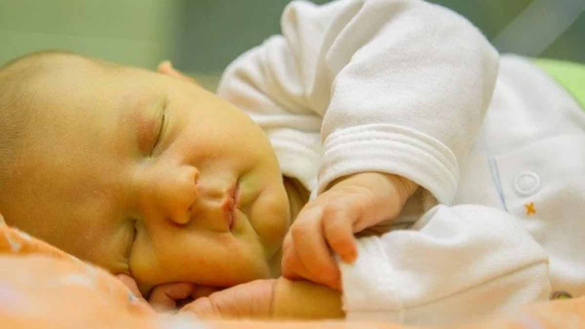 Желтуха новорожденных отзывы. Физиологическая желтуха новорожденных. Что такое желтушка у новорожденных детей.