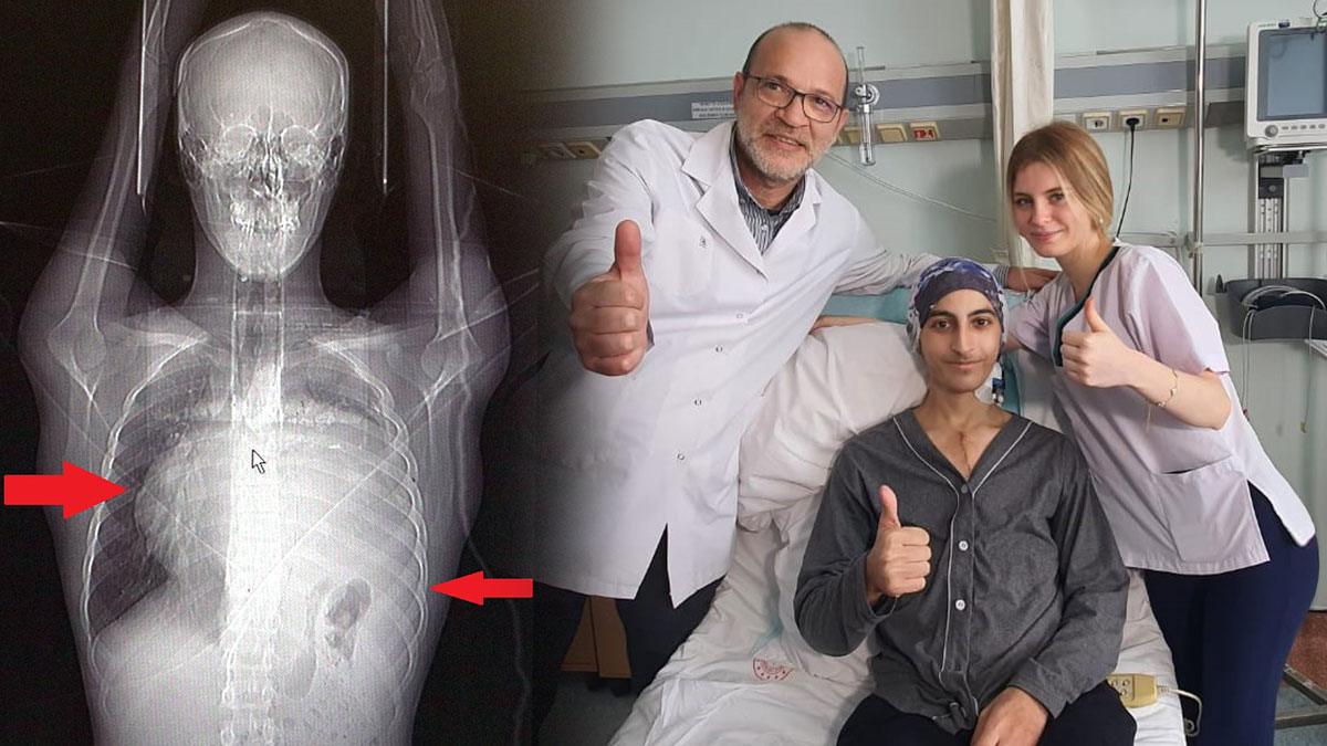 Halsizlik şikayetiyle doktora gitti: Röntgen sonuçları doktorları şoke etti! Tıp literatüründe ilk, meğer kalbi...