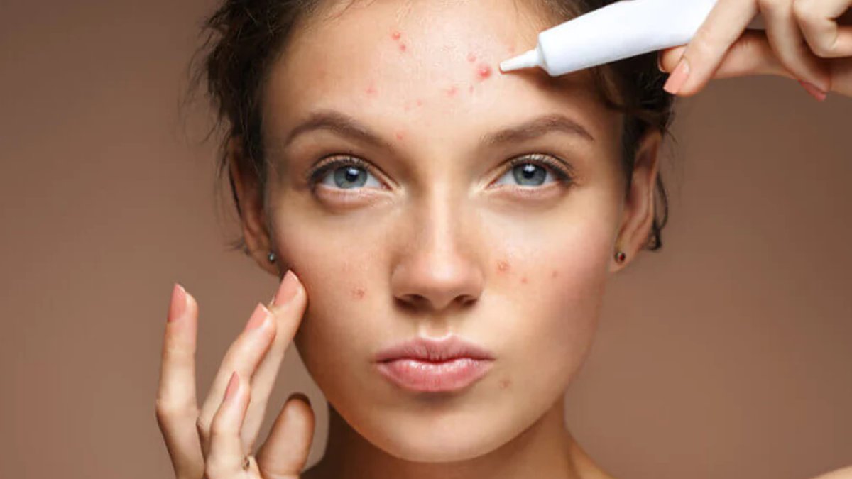 Salisilik Asit Nedir ve Ne İşe Yarar?