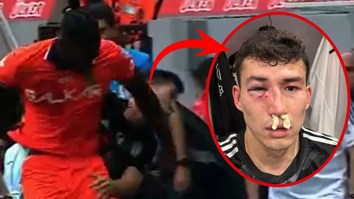 Tanınmaz hale geldi! Beşiktaş futbolcusu Zaynutdinov hakkında ilk açıklama: Yüzünde kırılmadık yer kalmamış