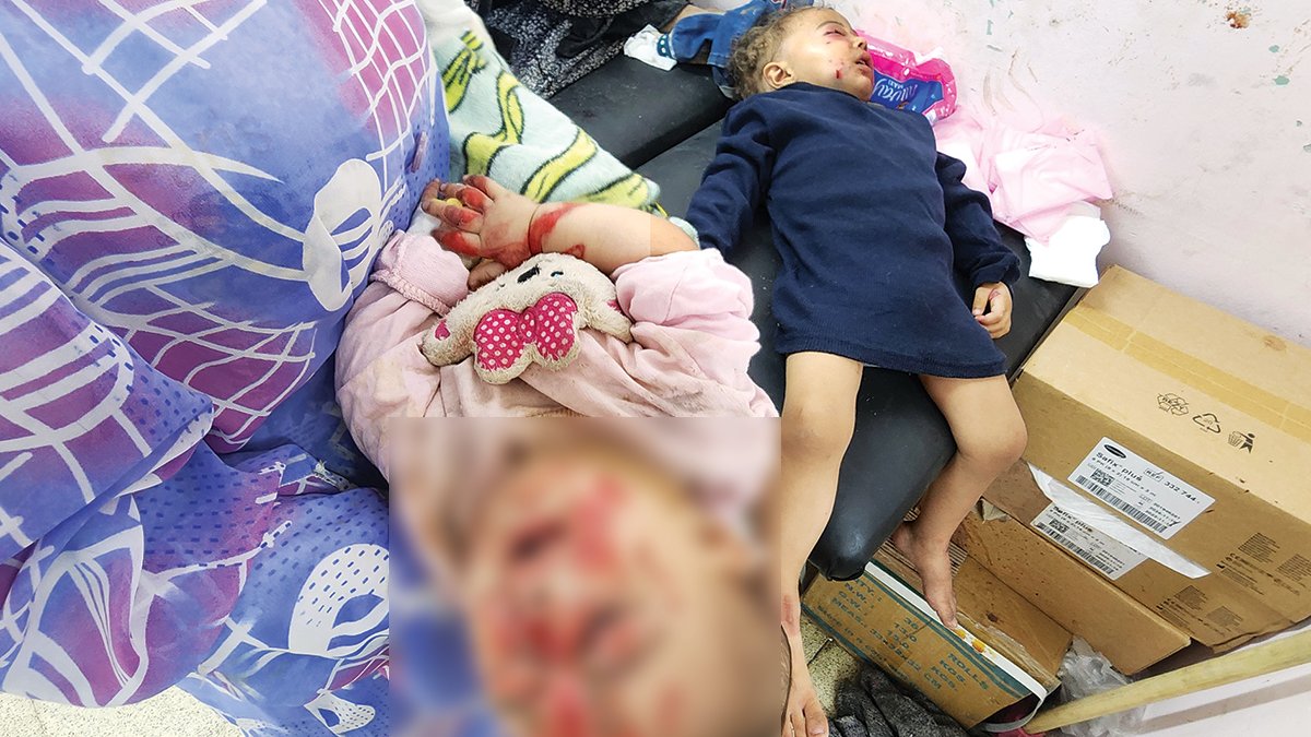 Canlı kalmasın bombardımanı