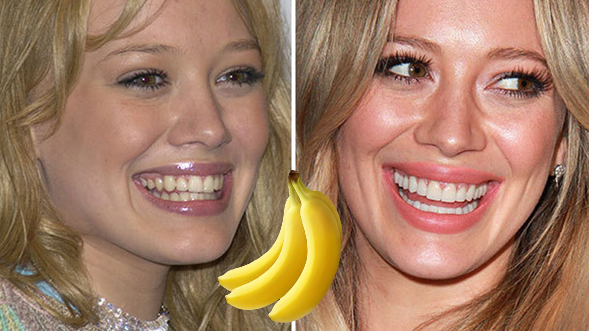 Sararan dişleriniz için gereken tek şey muz! Meğer bembeyaz dişler hayal değilmiş