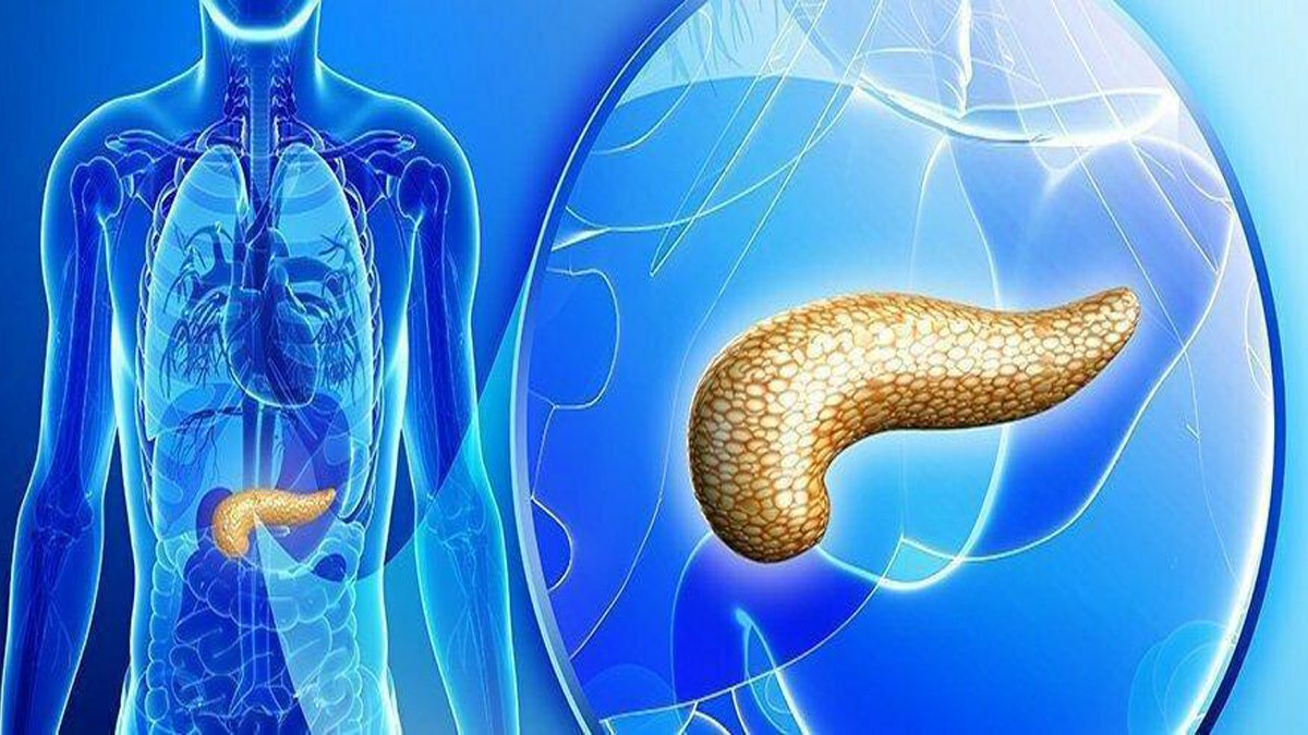 Pankreas kanseri belirtileri