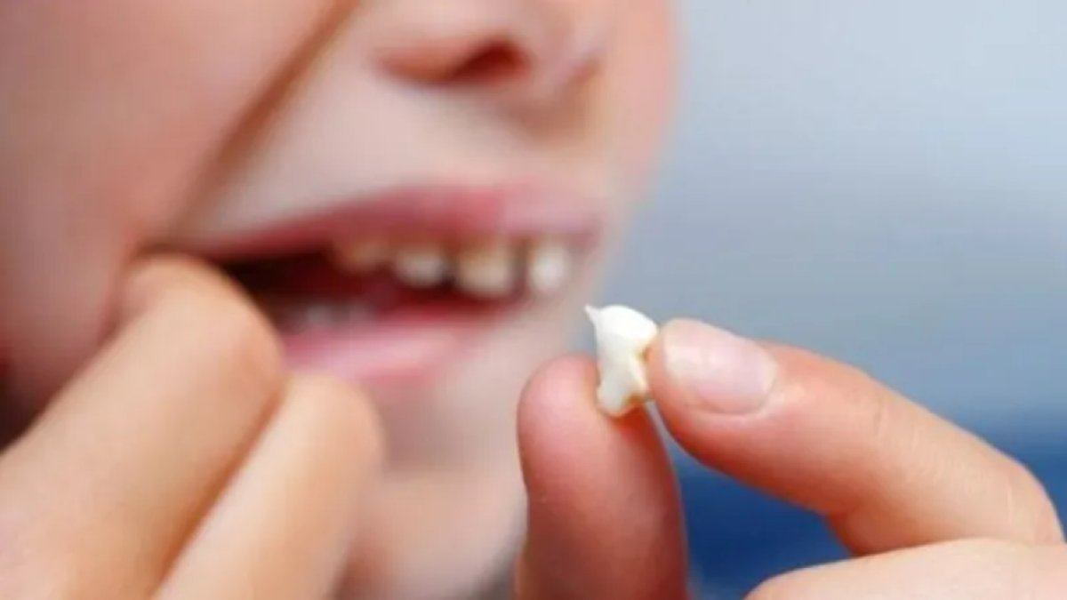 Rüyada Dişinin Düştüğünü Görmek: Anlamı ve Yorumları