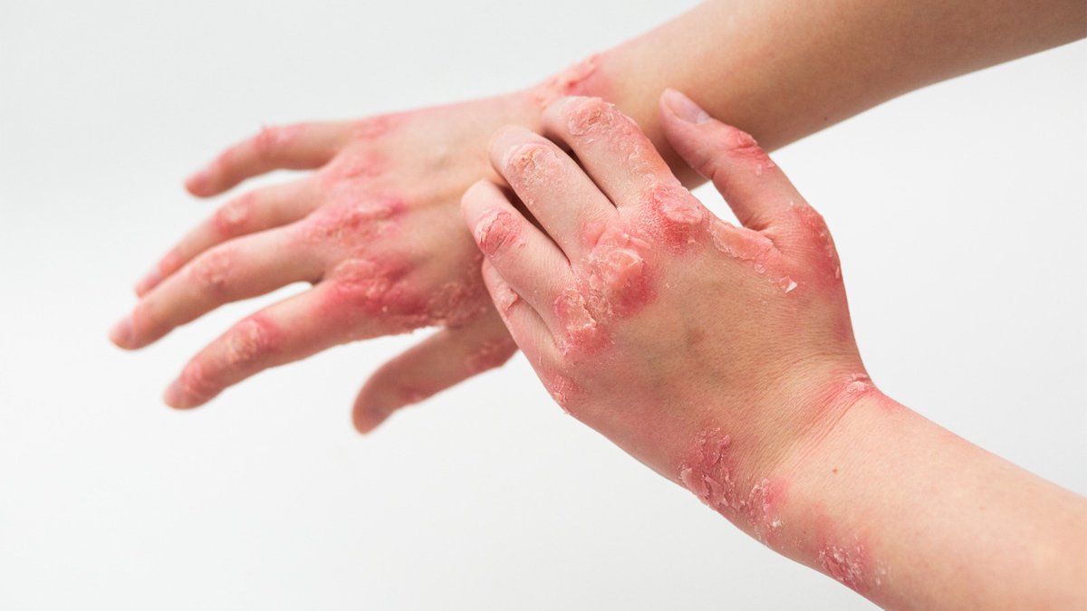 Egzama nasıl geçer?