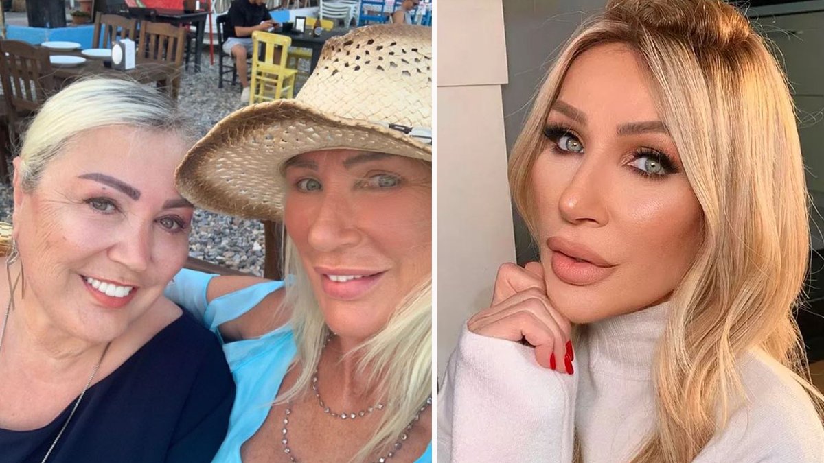 Yanlış işlem sonucu yüzü deforme olmuştu! Ablası da Seda Sayan'a özendi! Kendi adeta baştan yarattı!