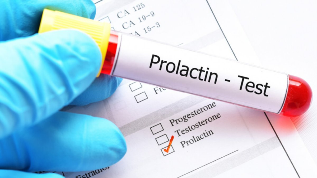 Prolaktin Yüksekliği: Sağlık Sorunları ve Tedavi Yöntemleri