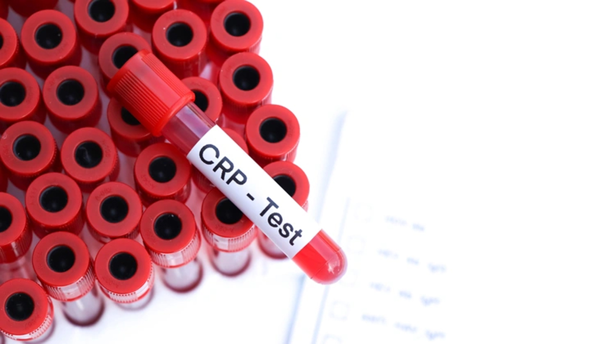 Crp yüksekliği nedir?