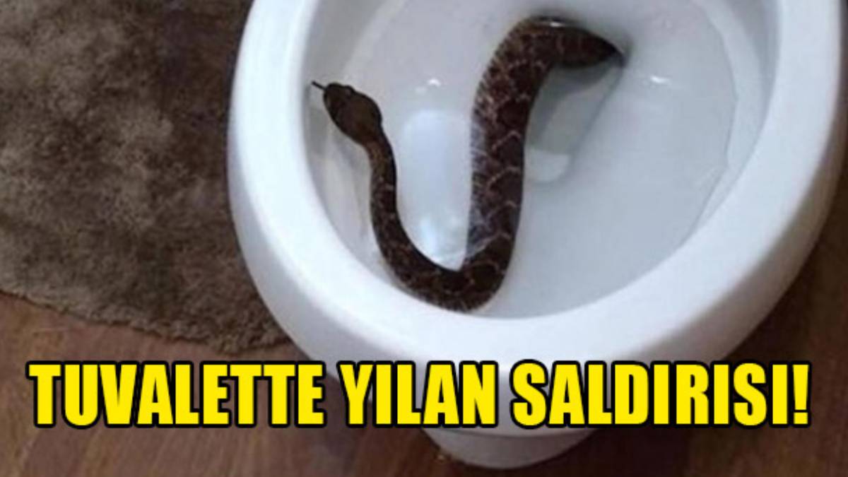 Kabus gerçek oldu! Tuvaletten çıkan dev piton adamı öyle bir yerinden ısırdı ki... Apar topar hastaneye kaldırıldı