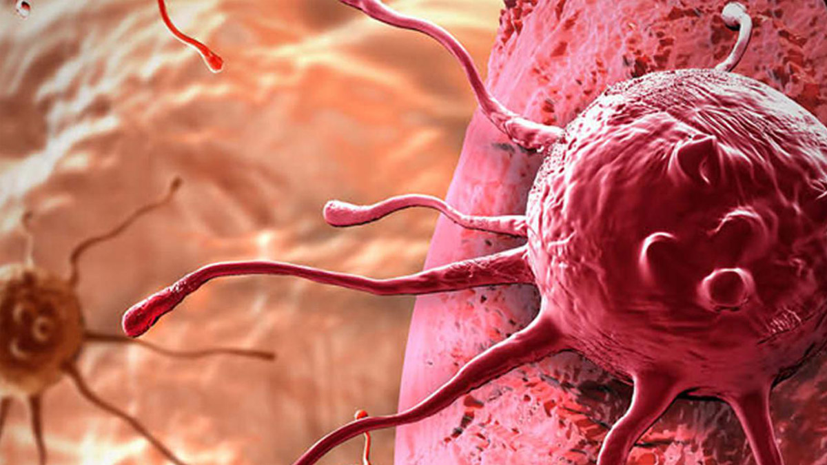 Lenfoma kanseri belirtileri